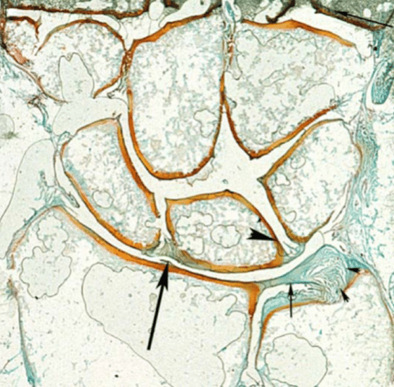 imagine la microscop cu ligamentul scafo-semilunar